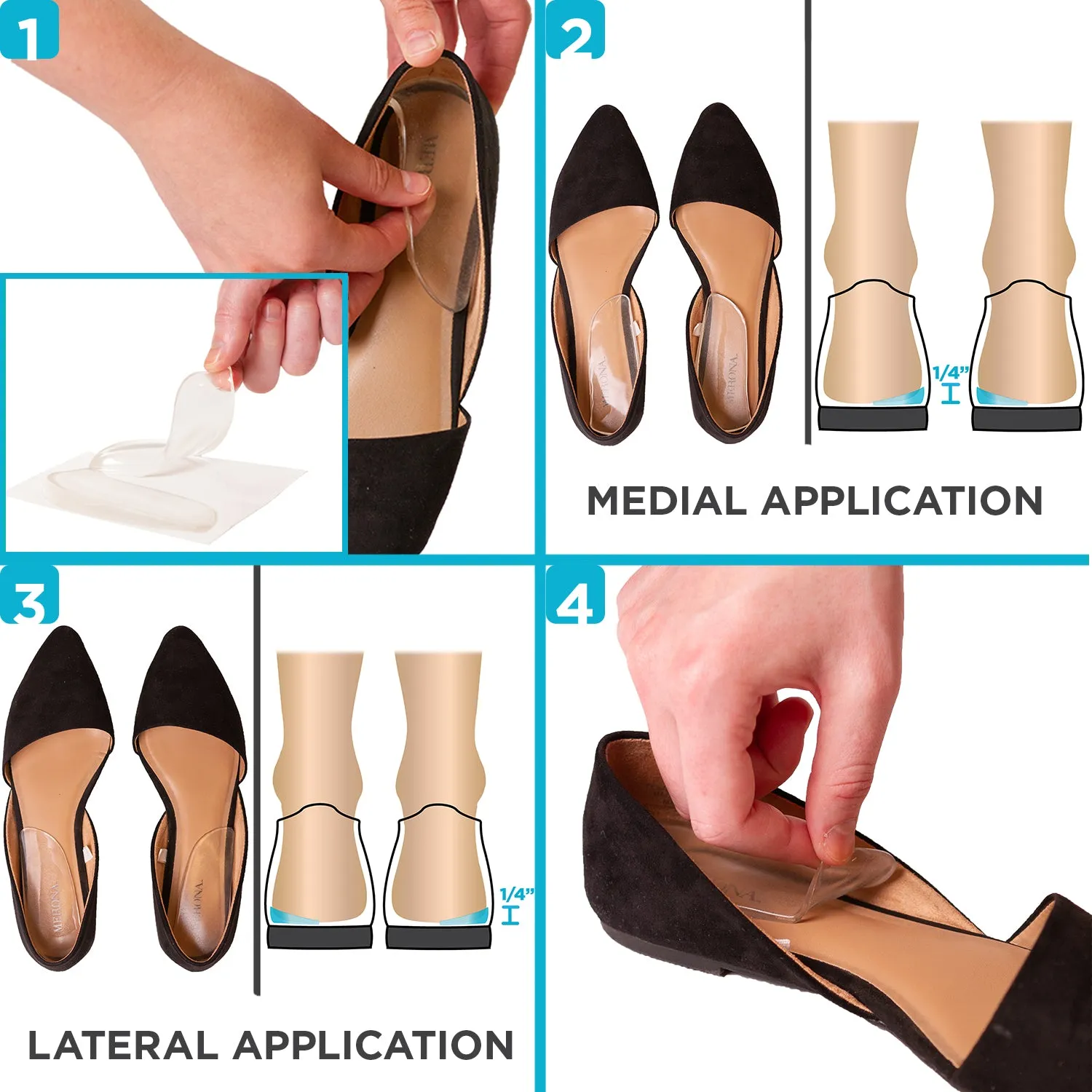 Medial & Lateral Heel Wedge Inserts for Overpronation or Supination Correction (Pair)