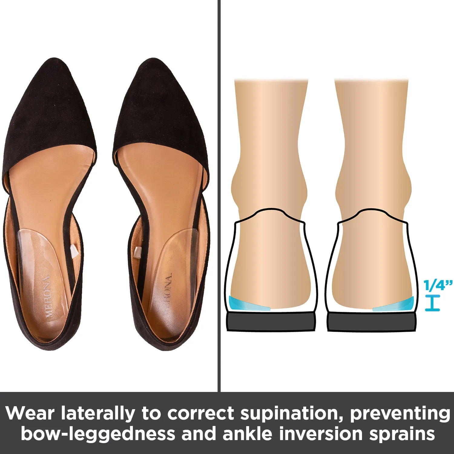 Medial & Lateral Heel Wedge Inserts for Overpronation or Supination Correction (Pair)