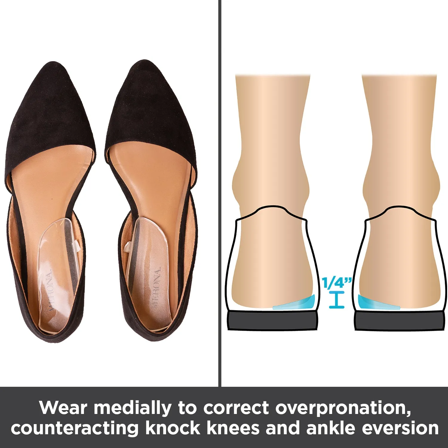 Medial & Lateral Heel Wedge Inserts for Overpronation or Supination Correction (Pair)